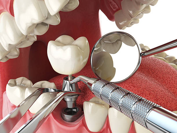 Best Weekend Emergency Dentist in Brighton, IL